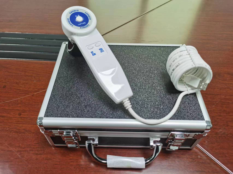 Câmera Digital de Iridologia d - Qh Furnitures avaliação e preço